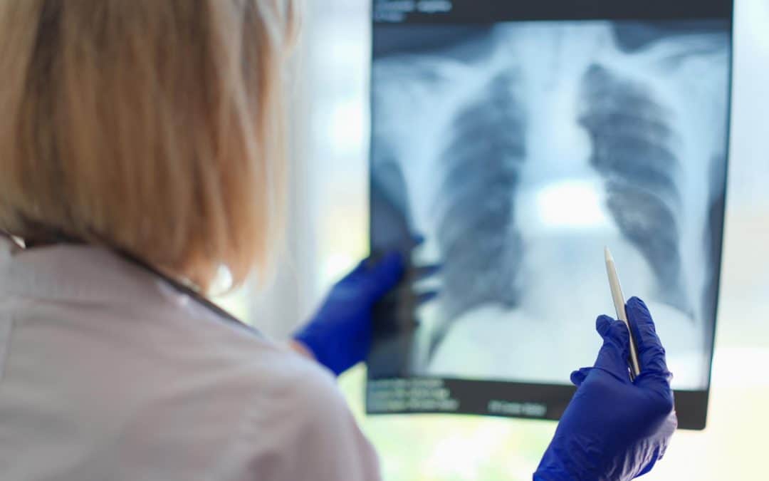 Emploi radiologue : 5 conseils pour recruter un radiologue