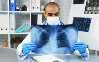 Offres d’emploi de BRM Conseil pour les médecins pneumologues : postulez dès maintenant